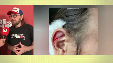 Santiago Segura. Santiago Segura.