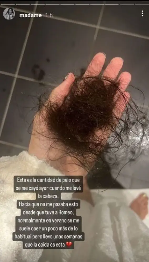 Madame de Rosa muestra la cantidad de pelo que se le cae