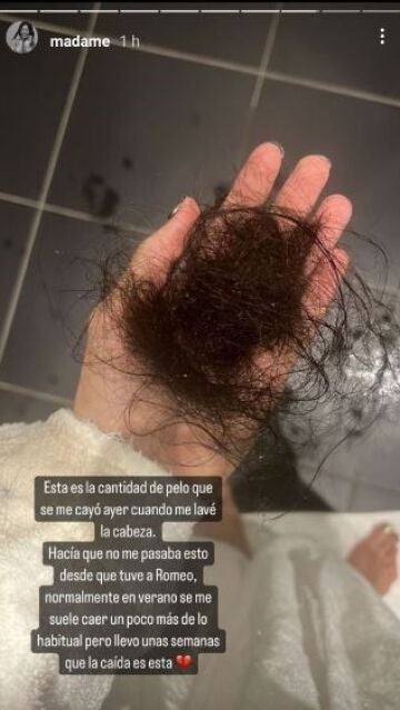 Madame de Rosa muestra la cantidad de pelo que se le cae