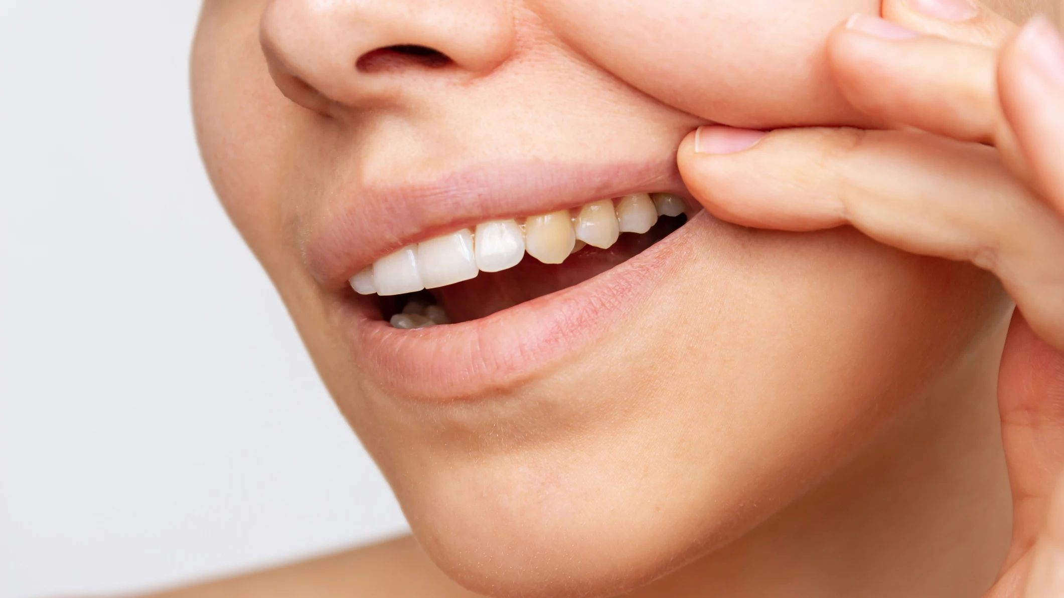Dientes oscuros Dientes oscuros