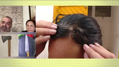 Hachazo en la cabeza Hachazo en la cabeza