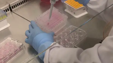 Extractos y pruebas en un laboratorio Viruela del mono