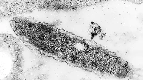 Segundo fallecido por legionela en Cáceres y seis hospitalizados más Segundo fallecido por legionela en Cáceres y seis hospitalizados más