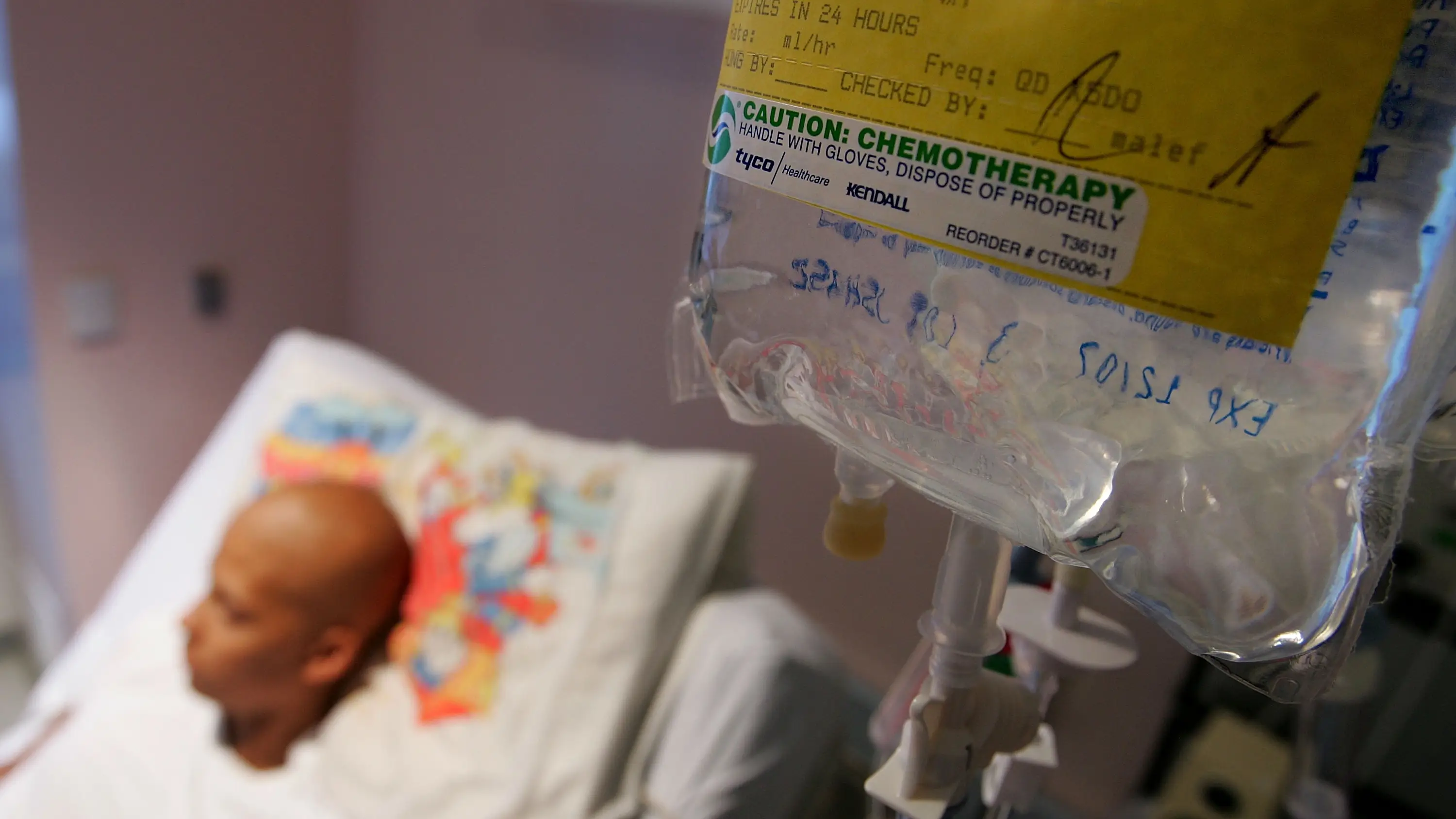 El s&iacute;ntoma que alerta de la Leucemia Mieloide Cr&oacute;nica
