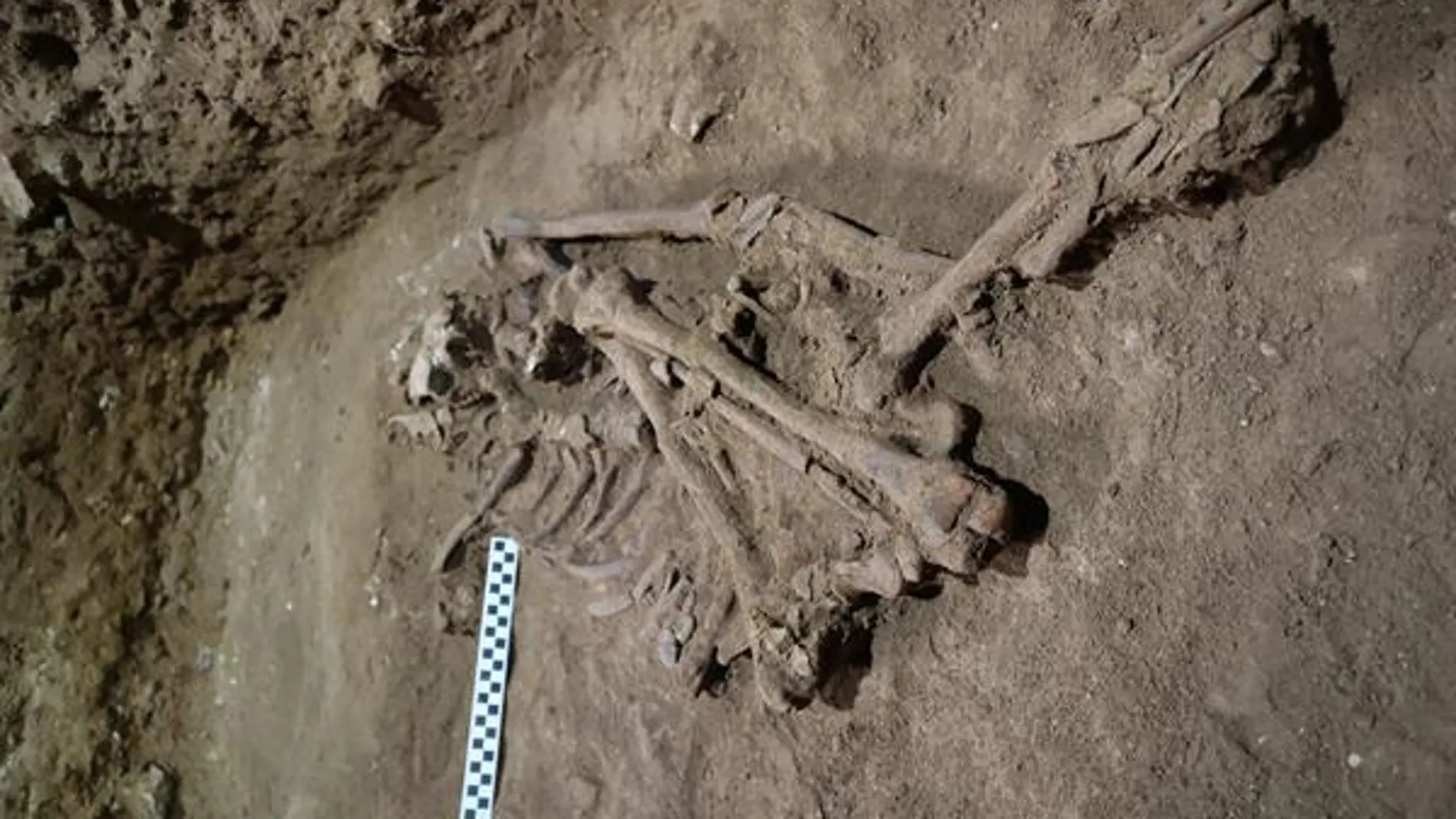 Los restos óseos del joven al que se le amputó un pie