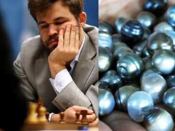 Perlas anales, ¿la última trampa en el ajedrez? 
