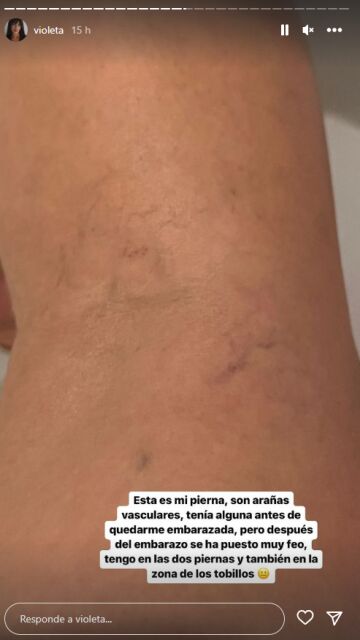 Violeta Mangriñán muestra sus arañas vasculares