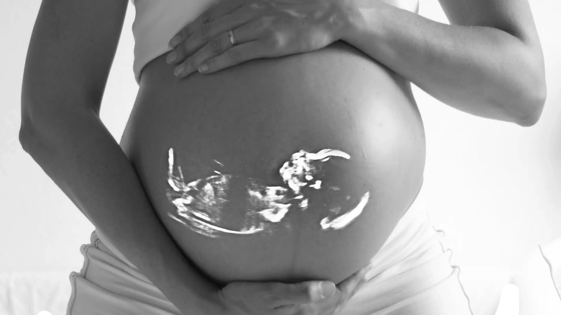 Una mujer embarazada, con el feto visto en su vientre a través de una radiografía Una mujer embarazada, con el feto visto en su vientre a través de una radiografía