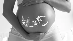 Una mujer embarazada, con el feto visto en su vientre a través de una radiografía