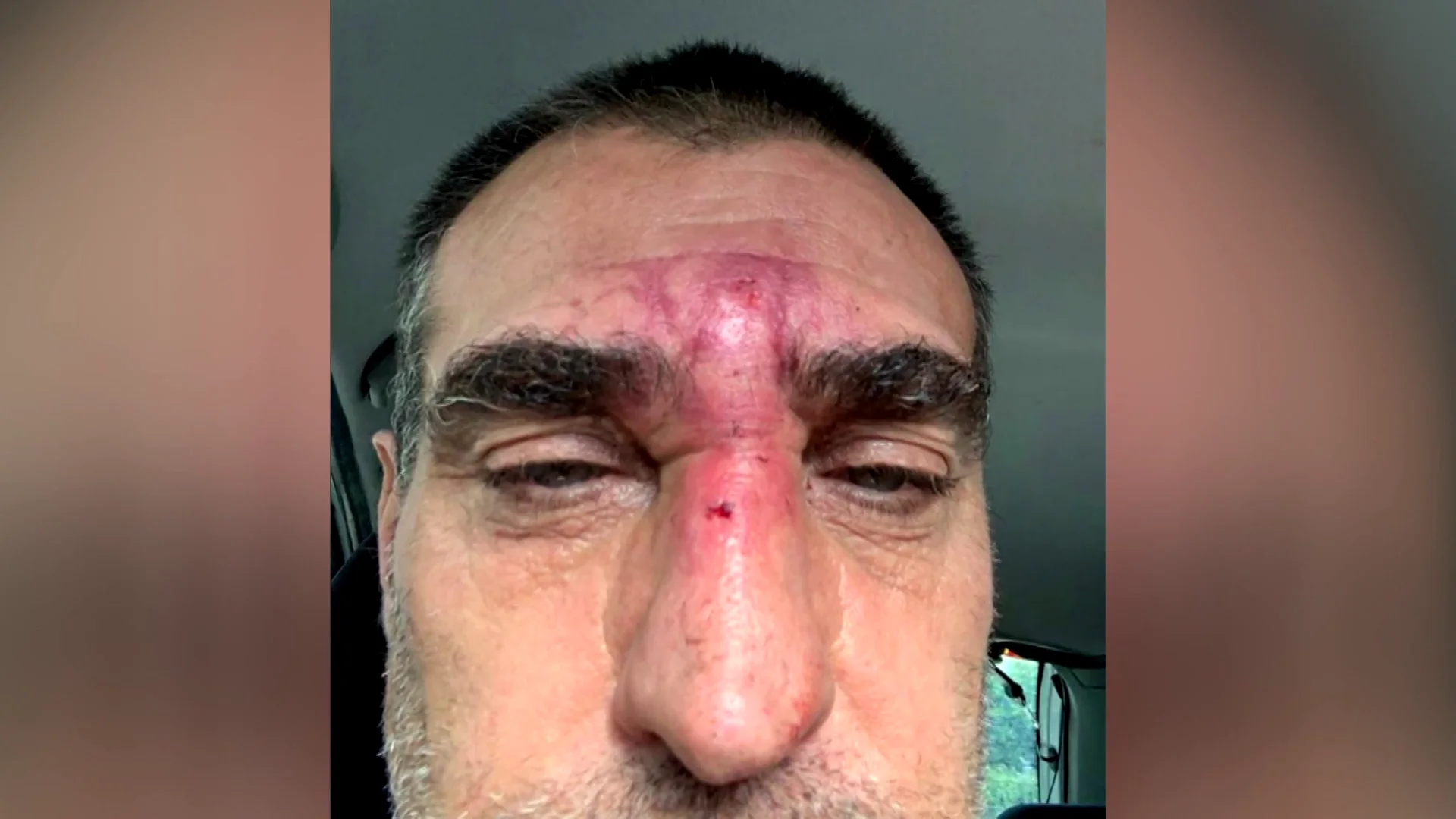Agredido tras defender a una v&iacute;ctima de violencia machista
