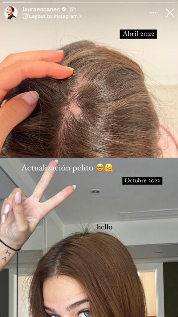 Laura Escanes muestra cómo tiene actualmente la pequeña calva respecto al mes de abril 