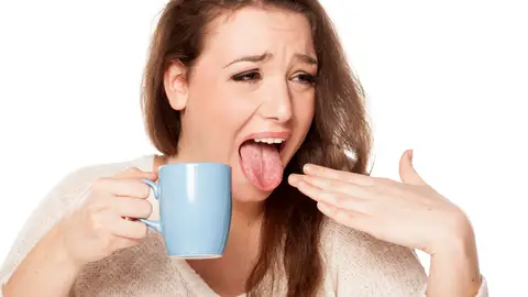 Quemarse la lengua Quemarse la lengua