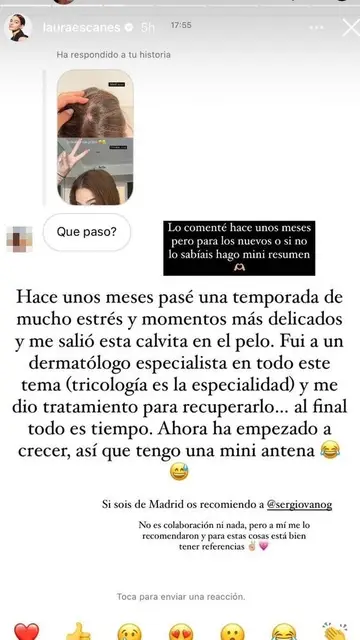 Laura Escanes explica lo que le pasó respecto a su "calvita" Laura Escanes explica lo que le pasó respecto a su "calvita"