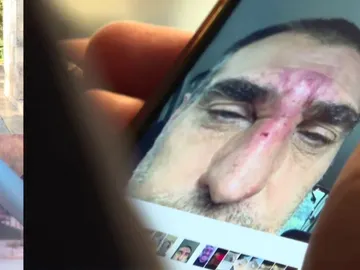 Recibe una paliza por tratar de defender a una chica que discutía con su novio en Burgos Recibe una paliza por tratar de defender a una chica que discutía con su novio en Burgos