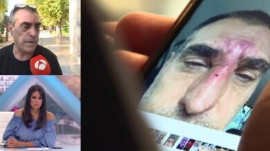 Un vecino de Burgos recibe una paliza tras llamar la atención a un joven que discutía con su novia