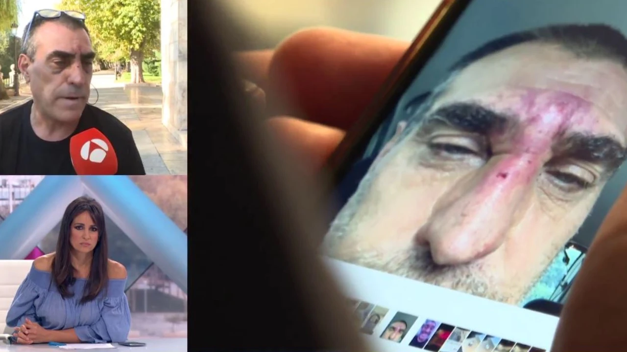 Recibe una paliza por tratar de defender a una chica que discut&iacute;a con su novio en Burgos