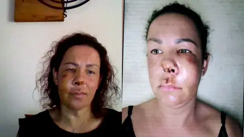 Agredida por el dueño de un perro. Agredida por el dueño de un perro.