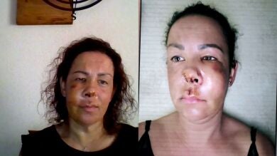 Una mujer recibe una paliza en Zaragoza por recriminar al dueño de un perro que lo llevara suelto: 