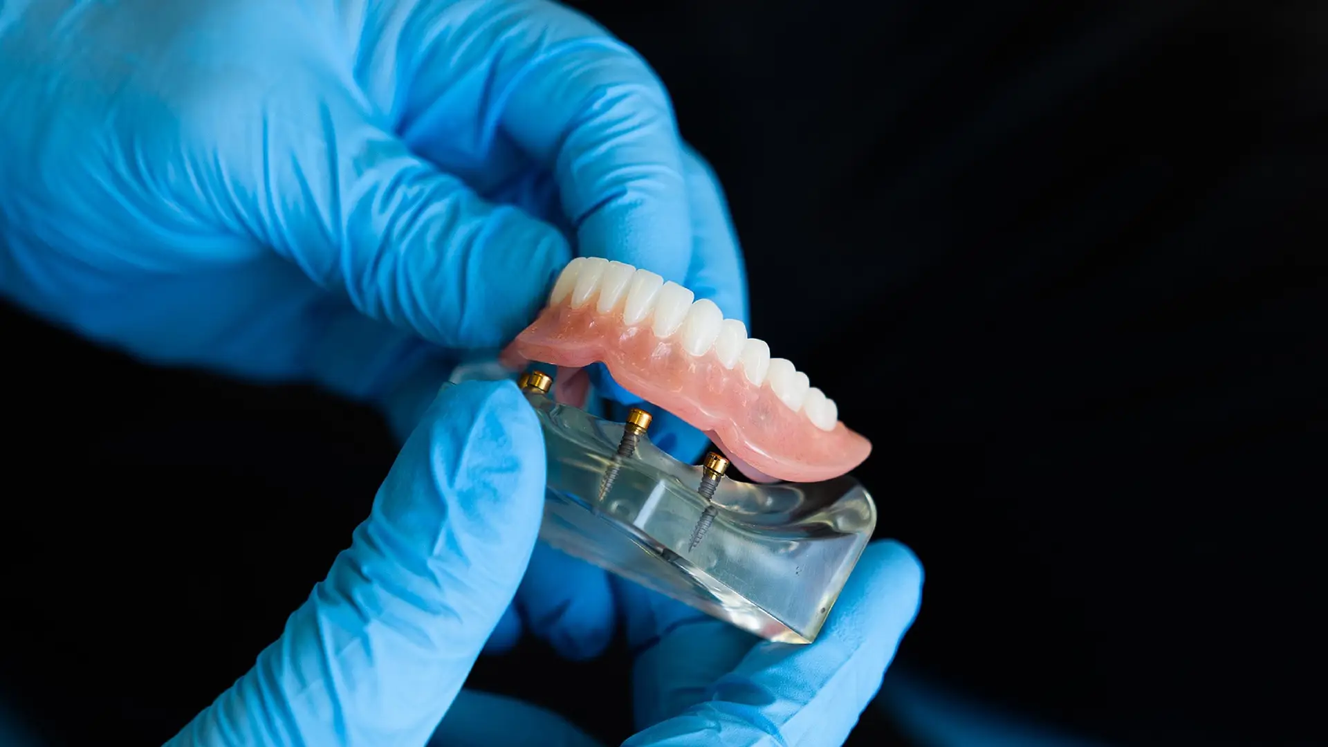 Imagen de una dentadura Imagen de una dentadura