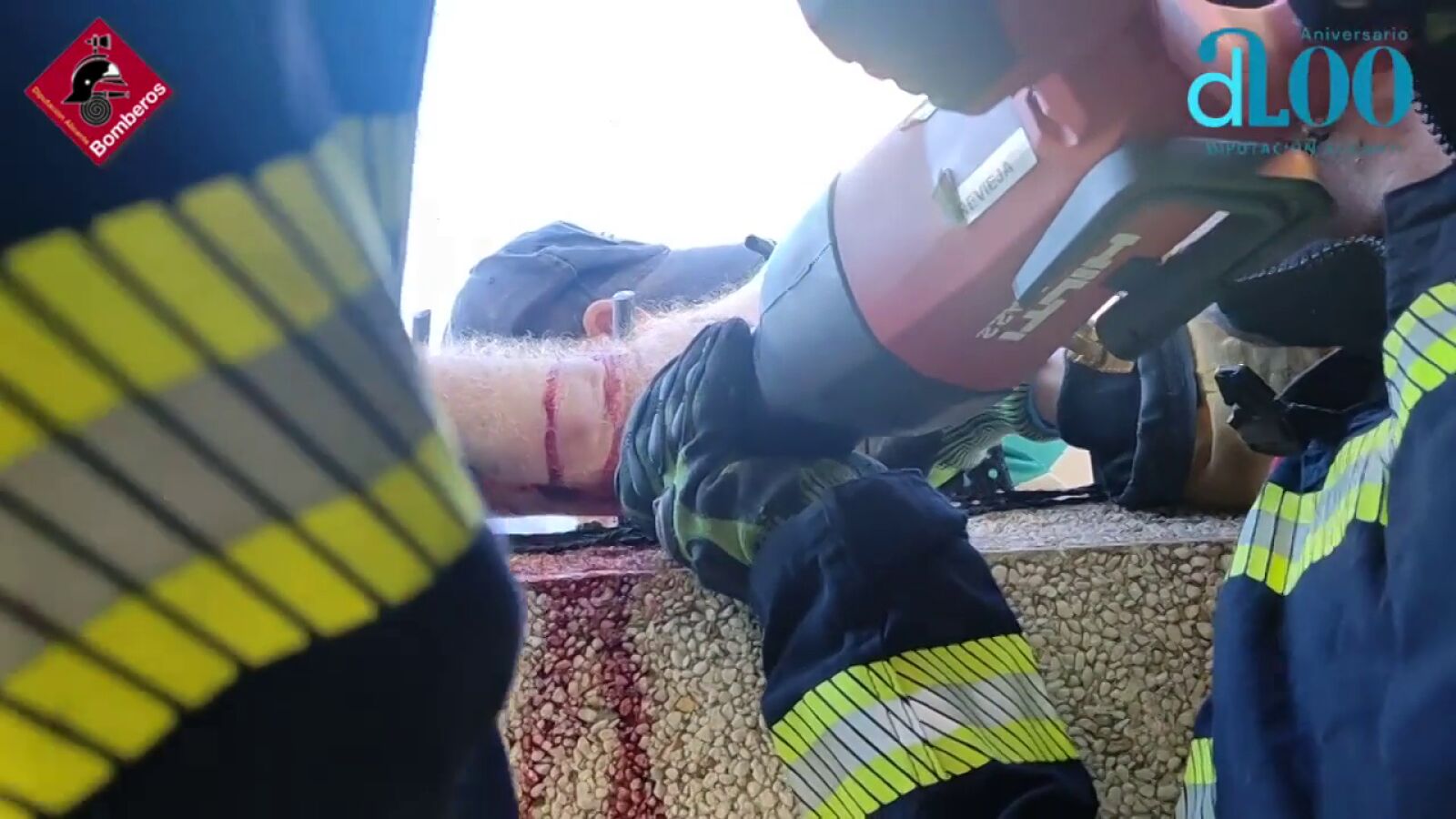 DURAS IMÁGENES: Un hombre se queda atrapado en un muro en Torrevieja al atravesarse el brazo con un hierro