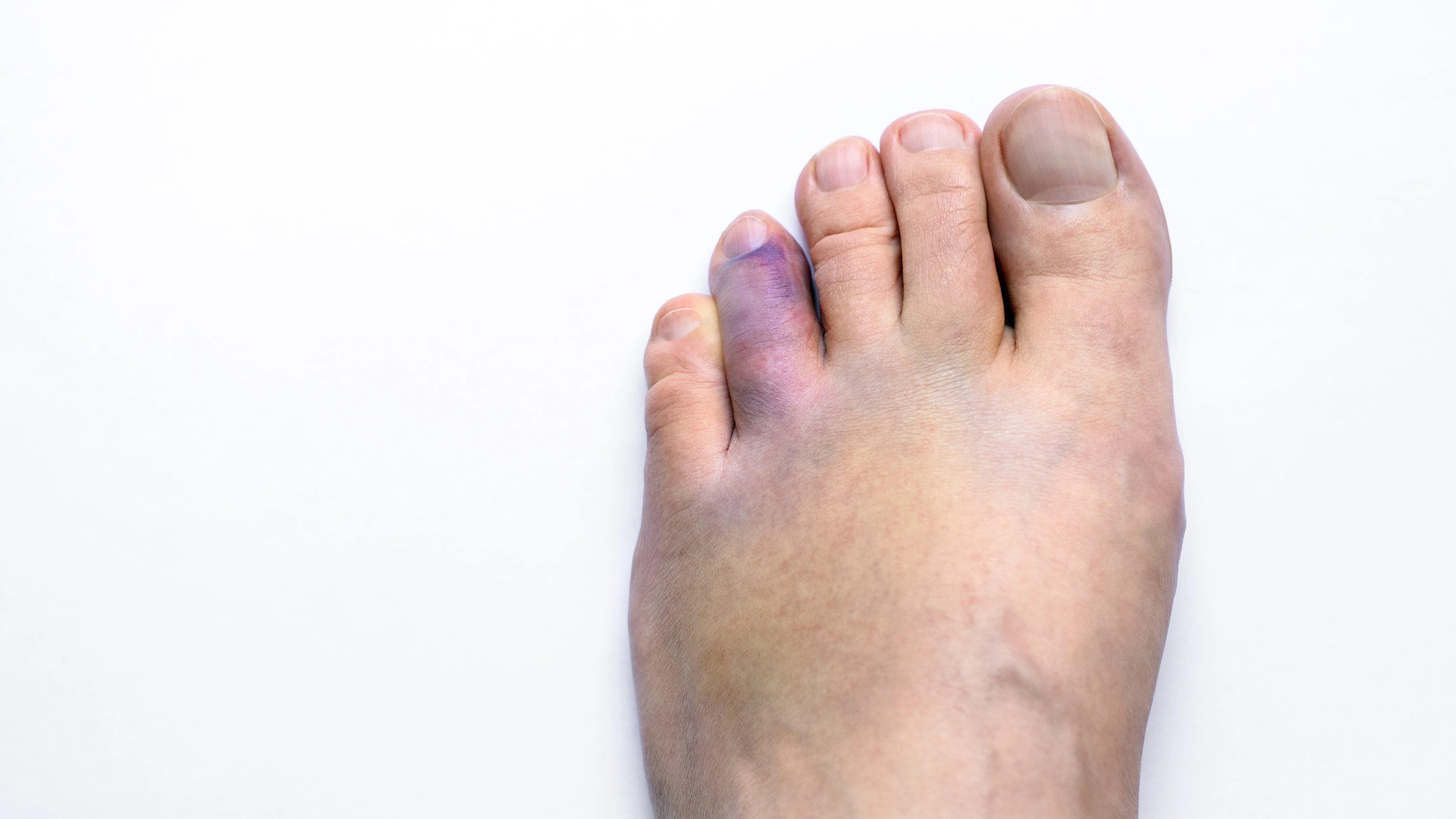 Pie lesionado