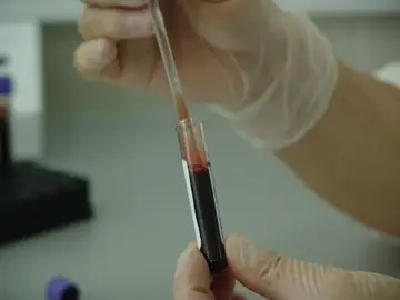 Un análisis en un laboratorio Un análisis en un laboratorio
