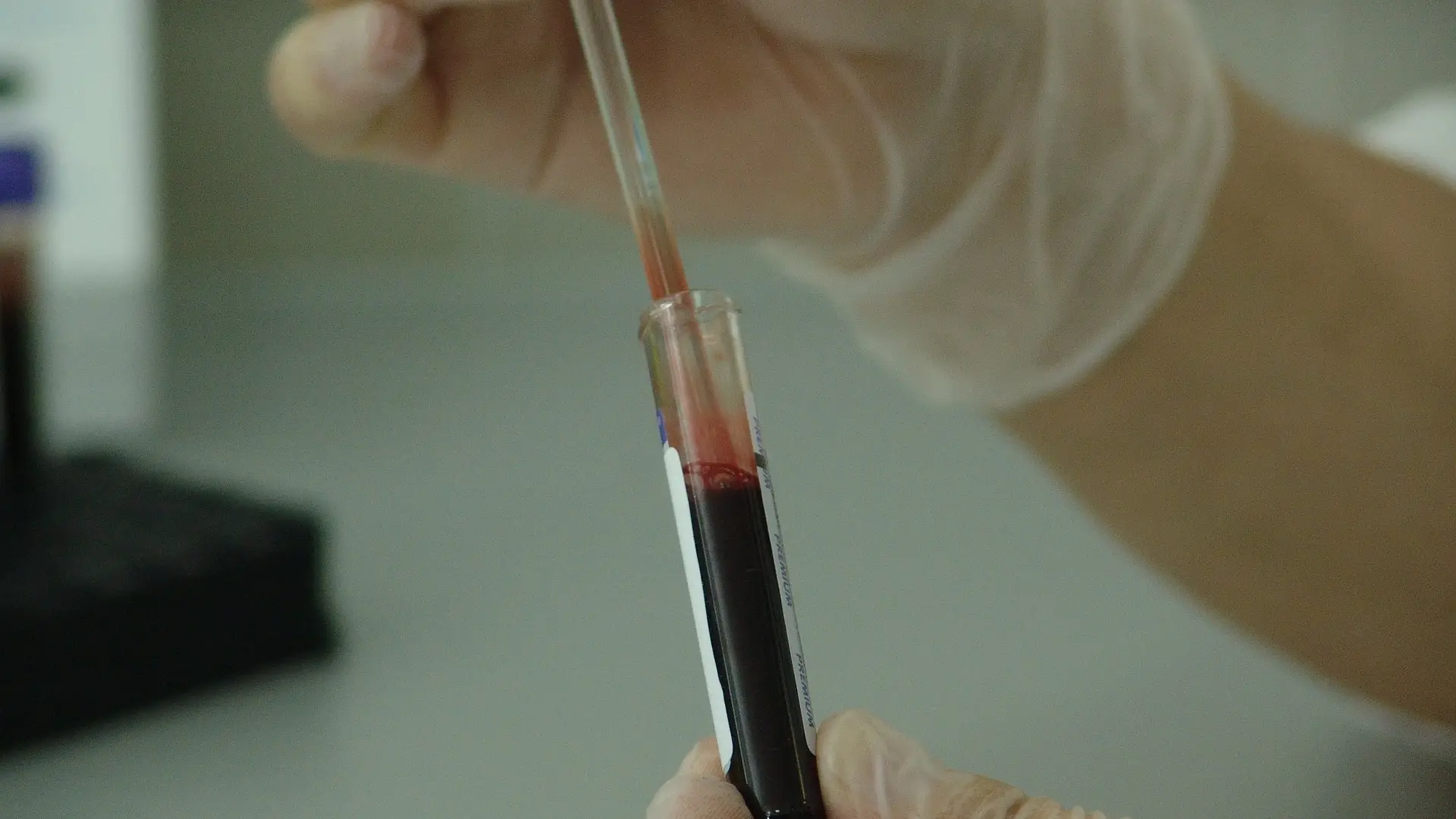 Un análisis en un laboratorio Un análisis en un laboratorio