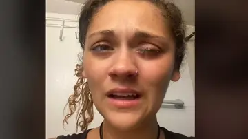Confunde el bote de gotas para los ojos con super pegamento Confunde el bote de gotas para los ojos con super pegamento