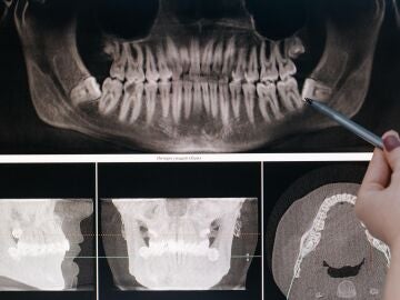 Radiografía maxilofacial