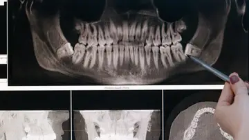 Radiografía maxilofacial