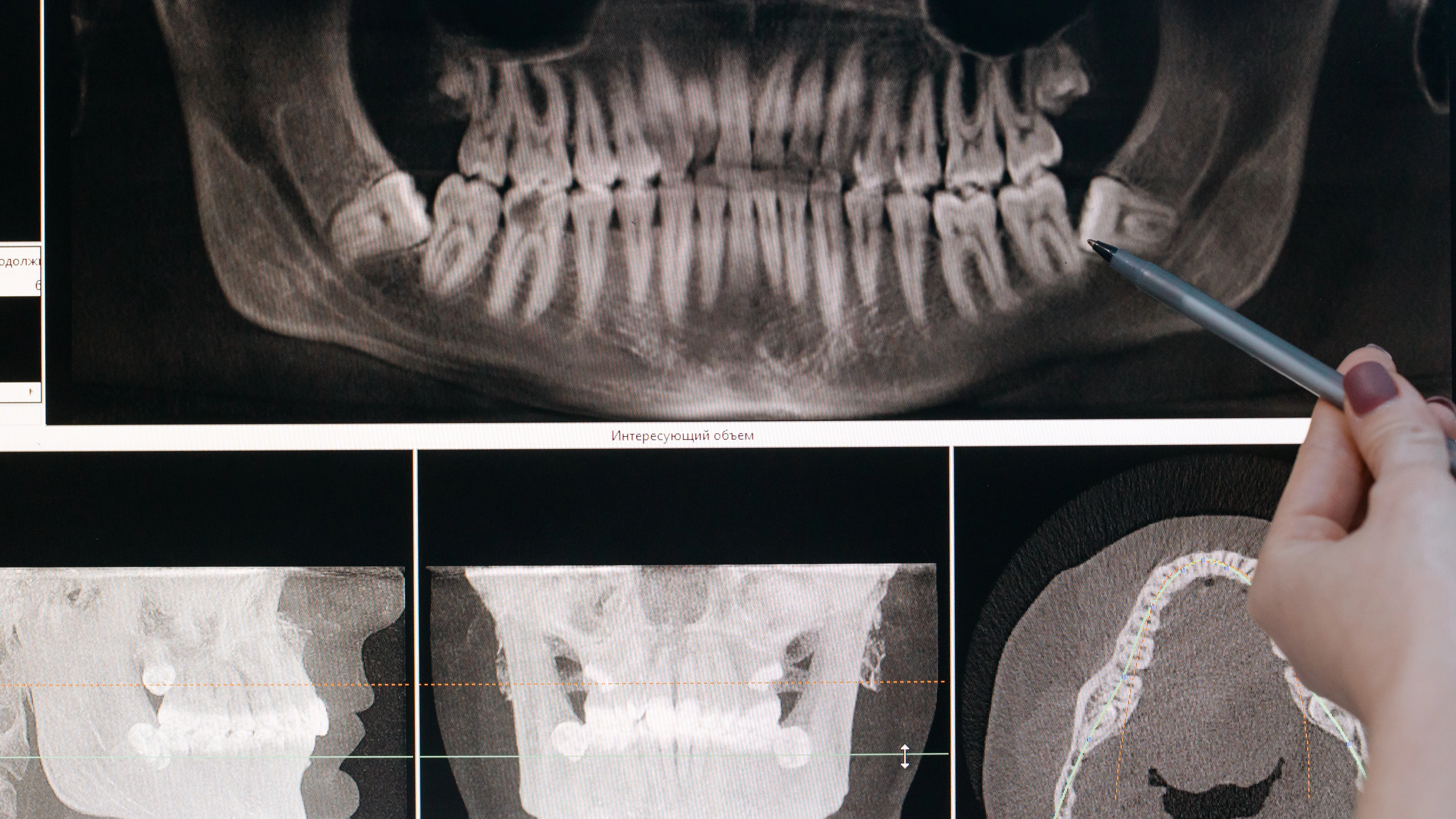 Radiograf&iacute;a maxilofacial
