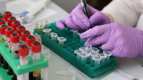 La UPV crea un test que detecta burundanga y "droga caníbal" con un móvil y en 15 minutos La UPV crea un test que detecta burundanga y "droga caníbal" con un móvil y en 15 minutos