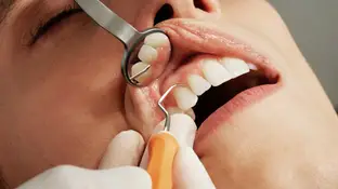 Imagen de una mujer en el dentista Imagen de una mujer en el dentista