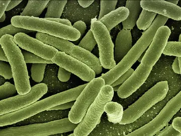Bacteria 'Strep A' Bacteria 'Strep A'