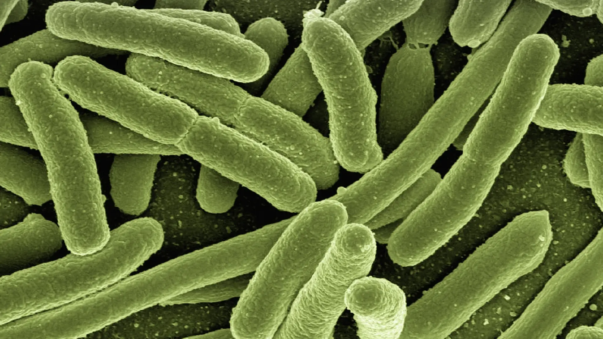 Bacteria 'Strep A' Bacteria 'Strep A'