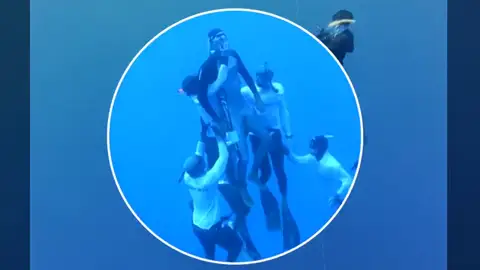 Desmayo en las profundidades: "Perdí el conocimiento" Desmayo en las profundidades: "Perdí el conocimiento"