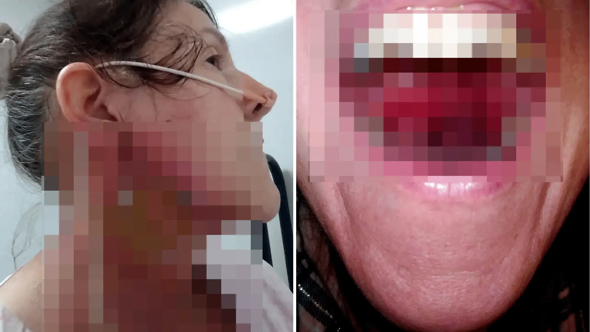 Acude al m&eacute;dico por un dolor de garganta y descubre que parece c&aacute;ncer