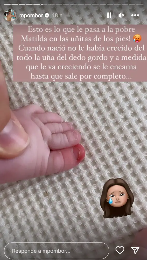 Marta Pombo enseña cómo se le encarna la uña del pie a su hija