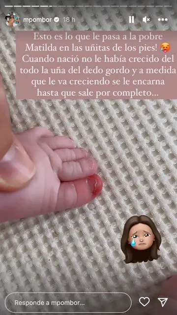 Marta Pombo enseña cómo se le encarna la uña del pie a su hija Marta Pombo enseña cómo se le encarna la uña del pie a su hija