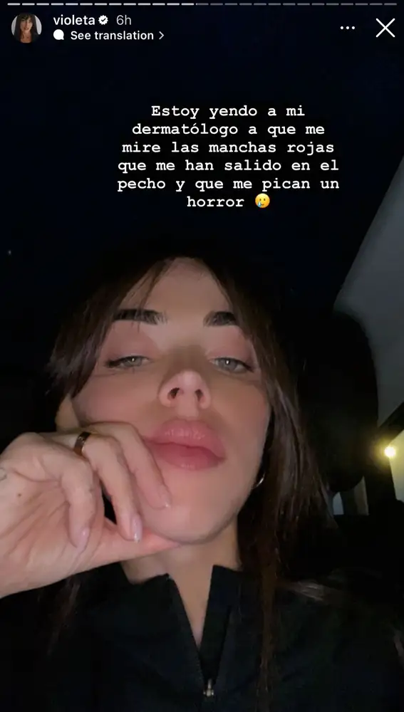 Manchas rojas