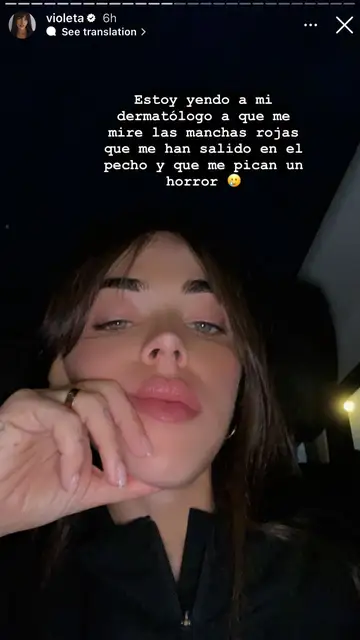 Manchas rojas Manchas rojas