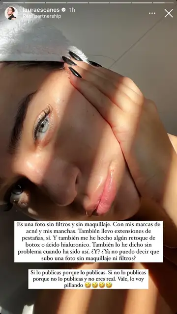 Sin filtros Sin filtros