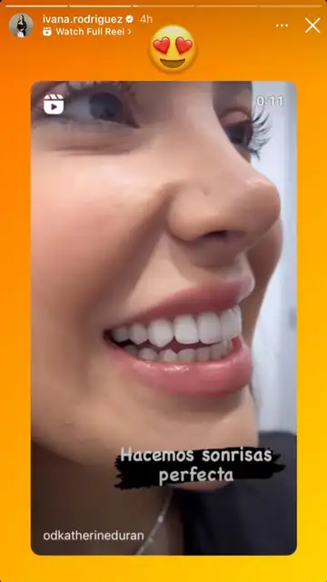 Nueva sonrisa Ivana Rodríguez Nueva sonrisa Ivana Rodríguez