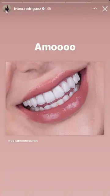 Nueva sonrisa Ivana Rodríguez Nueva sonrisa Ivana Rodríguez