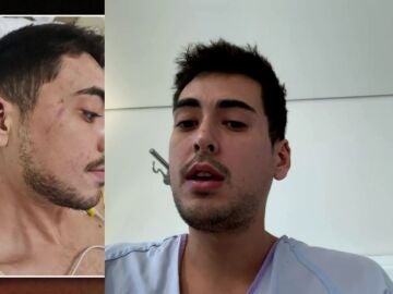 Agresi&oacute;n a un joven.
