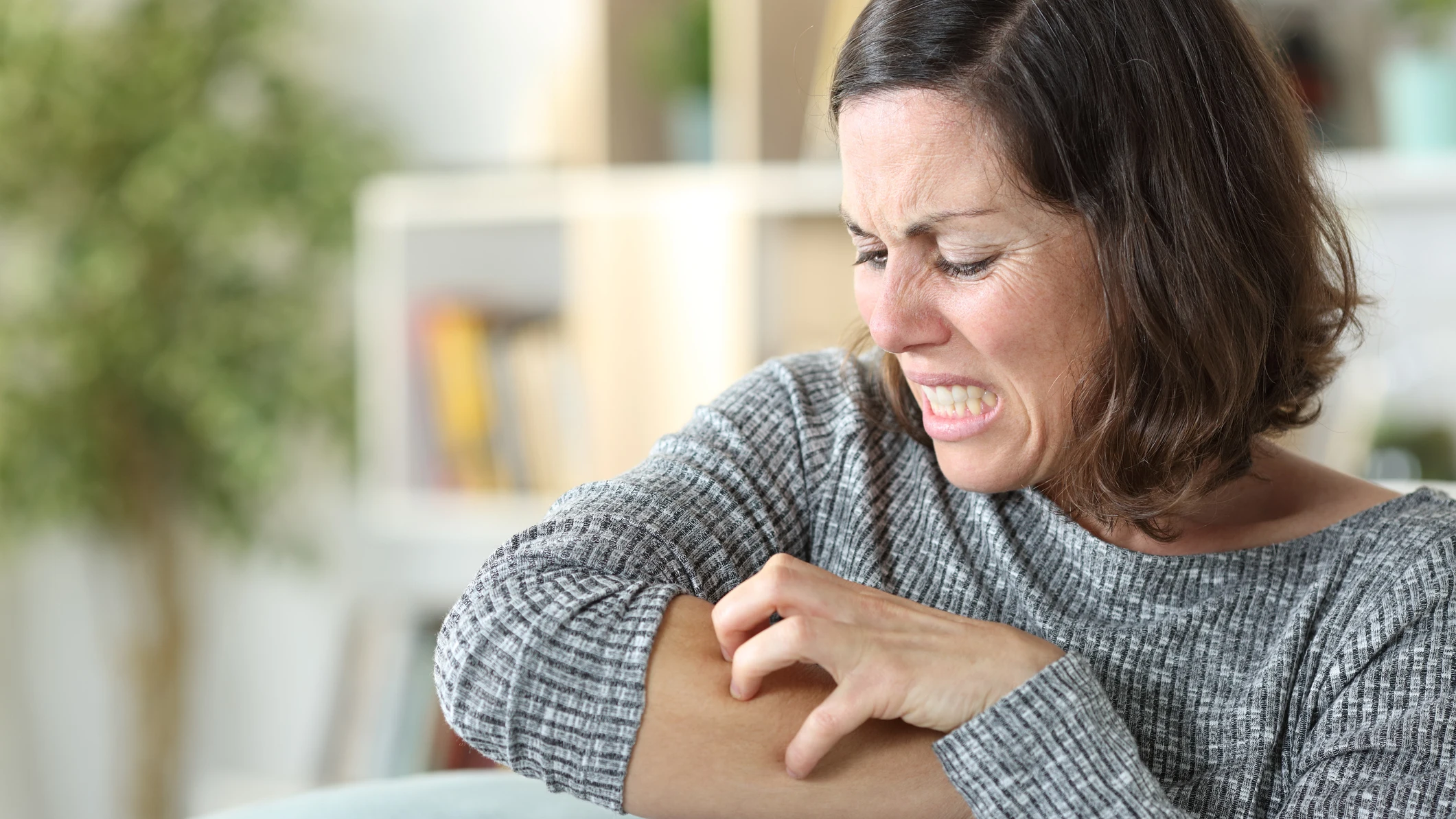 Mujer rascándose por alergia o estrés Mujer rascándose por alergia o estrés