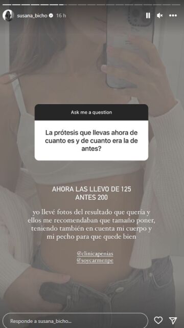 Susana Molina cuenta que ahora lleva unas prótesis de 125cc