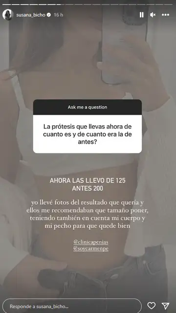 Susana Molina cuenta que ahora lleva unas prótesis de 125cc Susana Molina cuenta que ahora lleva unas prótesis de 125cc