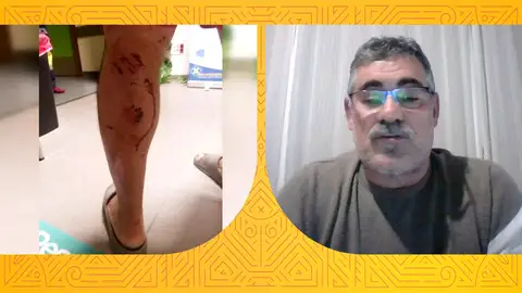 Félix Dasilva, atacado por cinco perros que le destrozaron los gemelos: "No se ha hecho nada todavía" Félix Dasilva, atacado por cinco perros que le destrozaron los gemelos: "No se ha hecho nada todavía"
