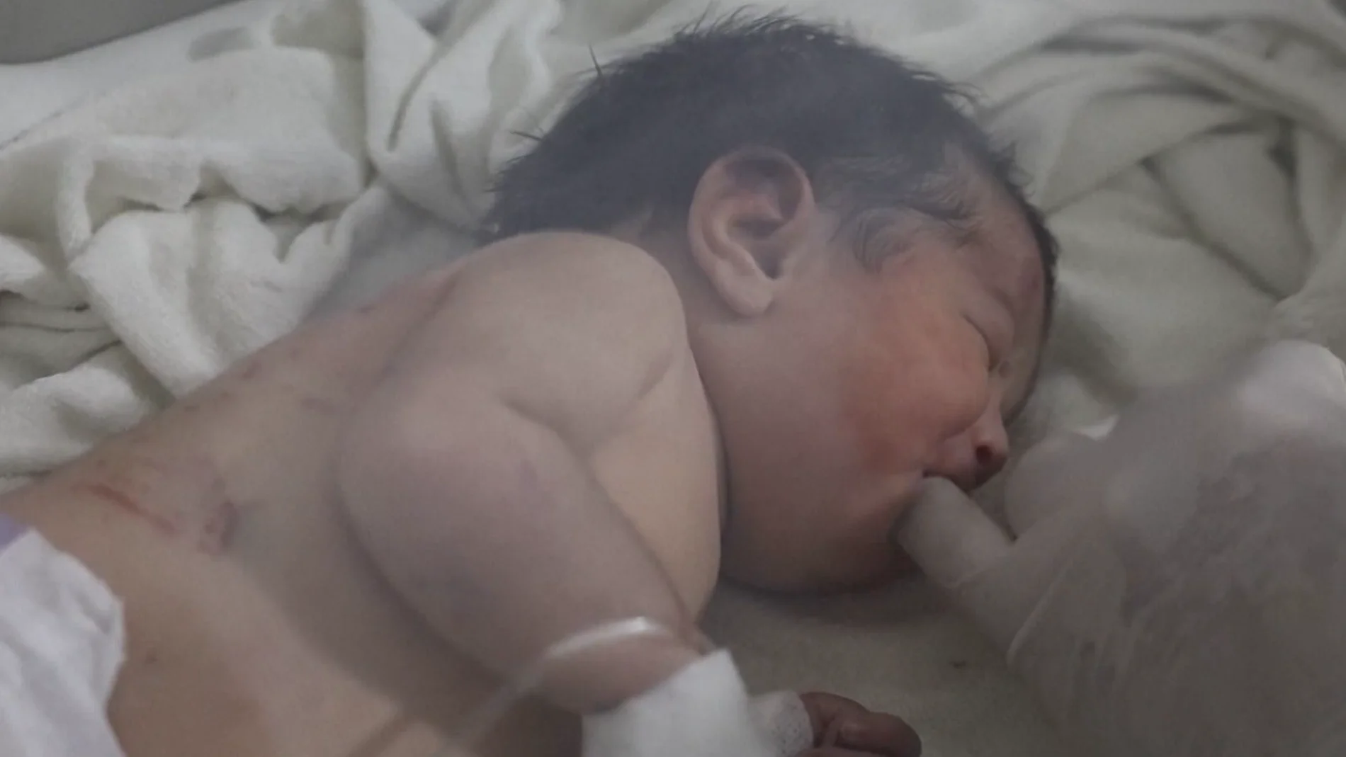 Aya, la niña milagro del terremoto en Turquía Aya, la niña milagro del terremoto en Turquía